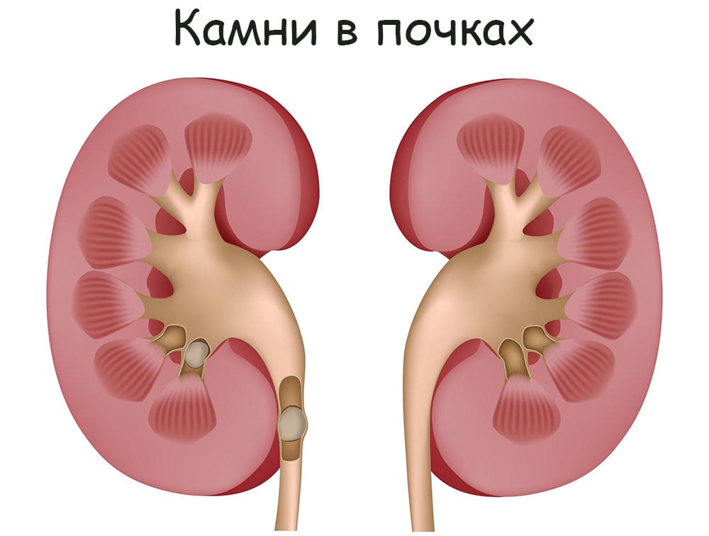 Ссылка кракен даркнет маркет